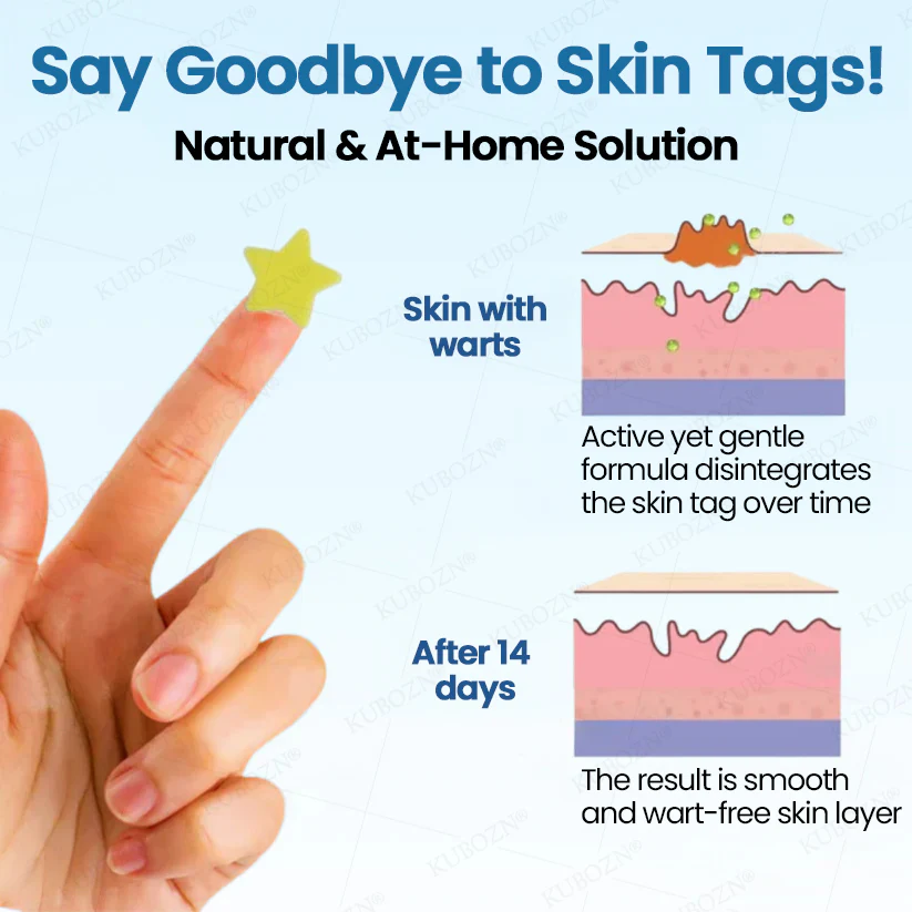 ✨KUBOZN® Pro MicroDarts Star Patch – Painless, Fast & Effective Skin Tag Removal - Image 6