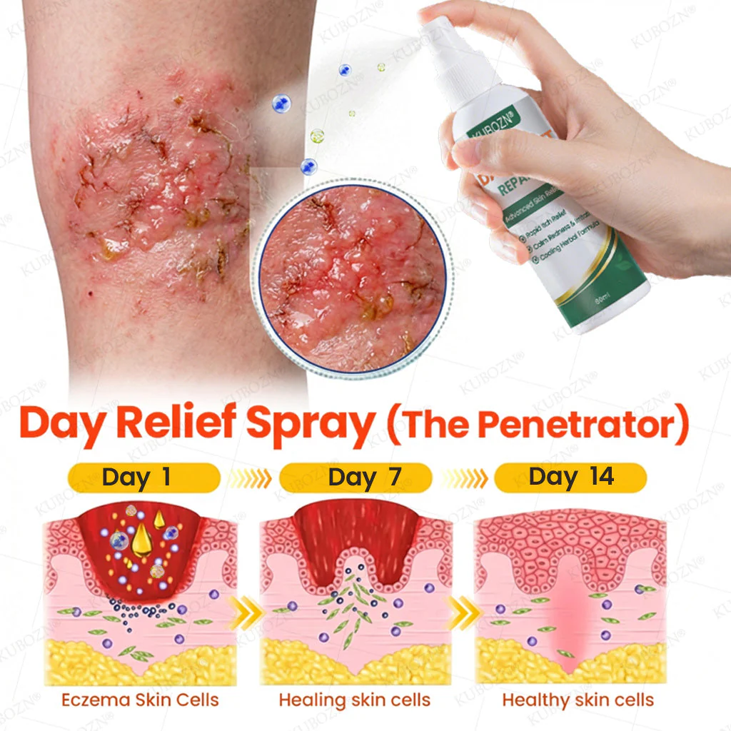 KUBOZN® Eczema Day & Night Repair System - 100% Steroid-Free Relief Duo for Intense Itch, Redness & Broken Skin (offer) - Image 2