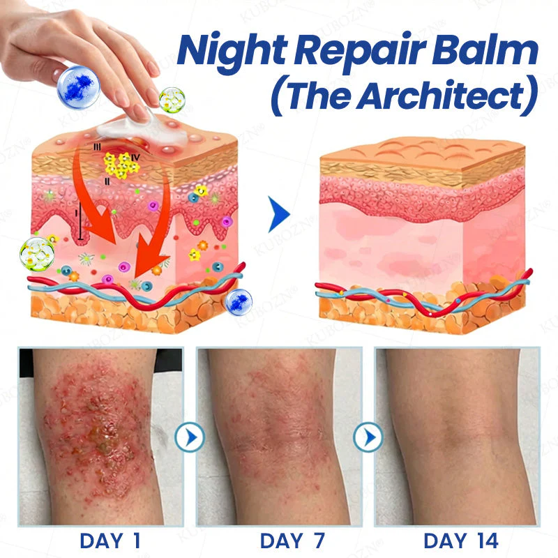 KUBOZN® Eczema Day & Night Repair System - 100% Steroid-Free Relief Duo for Intense Itch, Redness & Broken Skin (offer) - Image 3