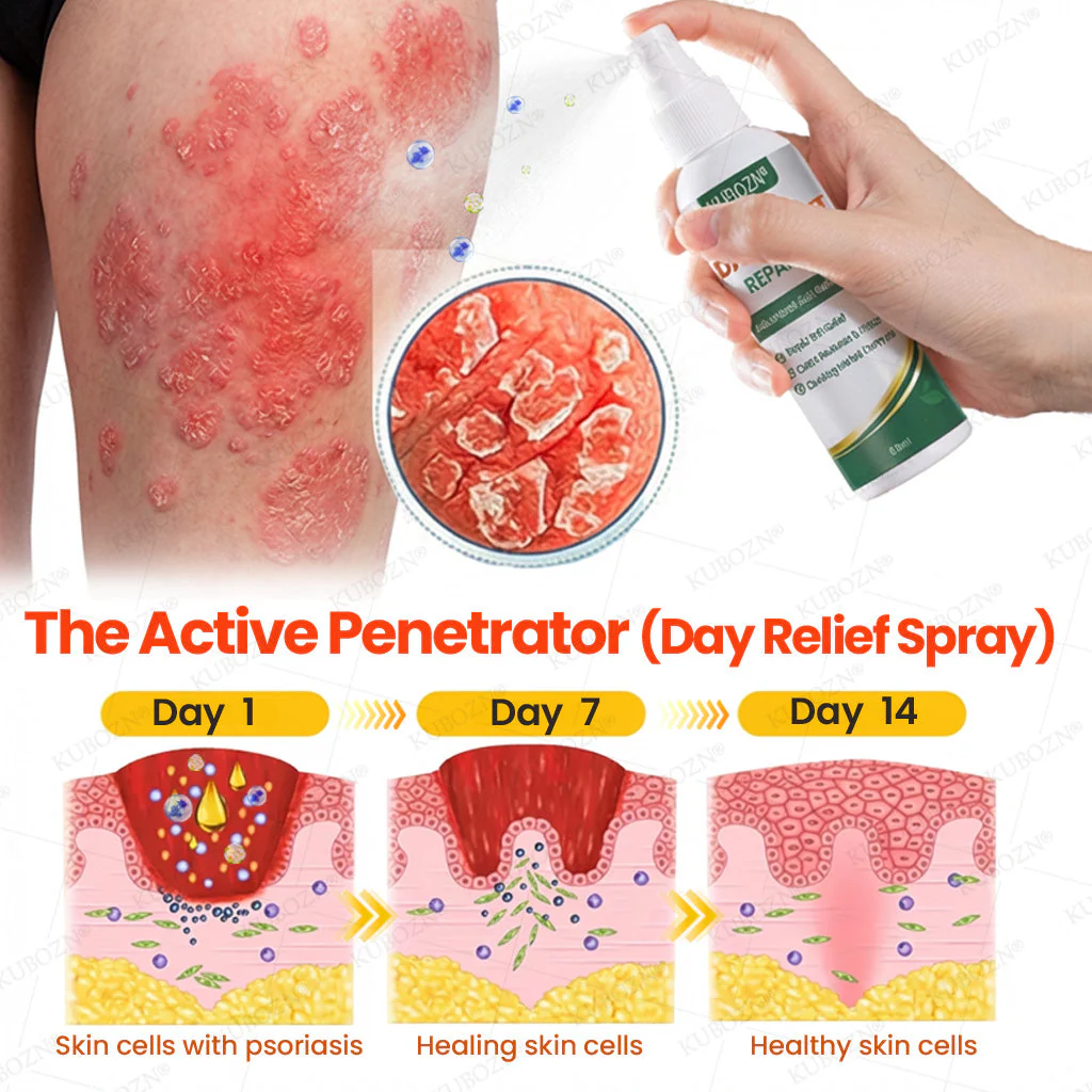 KUBOZN® Psoriasis Day & Night Repair System - 100% Steroid-Free Relief Duo for Plaques, Scaling & Itch (offer) - Image 2