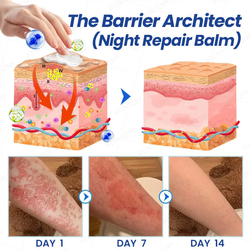 KUBOZN® Psoriasis Day & Night Repair System - 100% Steroid-Free Relief Duo for Plaques, Scaling & Itch (offer) - Image 3