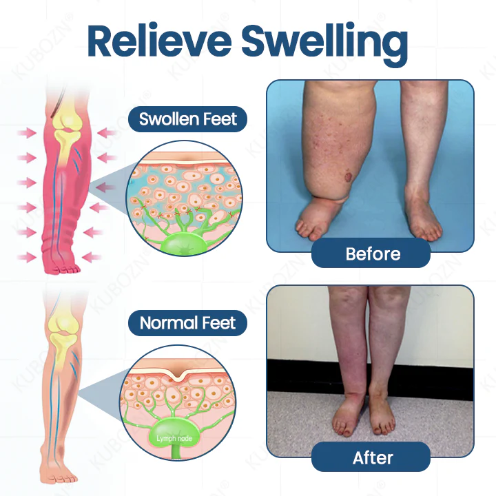 KUBOZN® Roll-On Cream for Lymphatic Drainage & Swelling Relief - Image 5