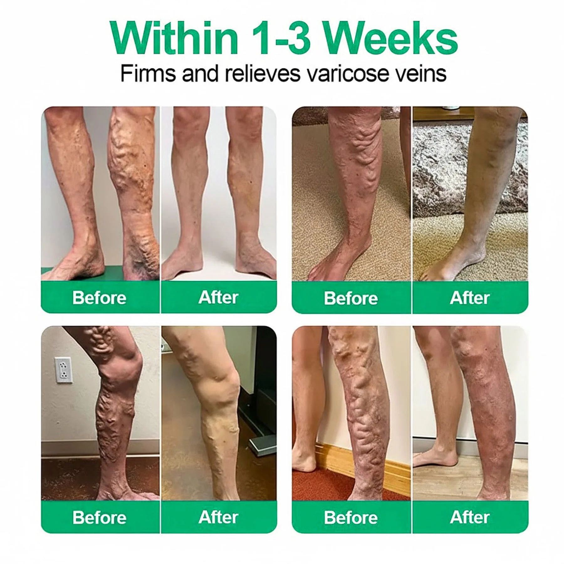 👨⚕️🔥Healrize® VeinEase Microneedle Care Patch⚡Instant Relief, Long-Term Results - Image 3