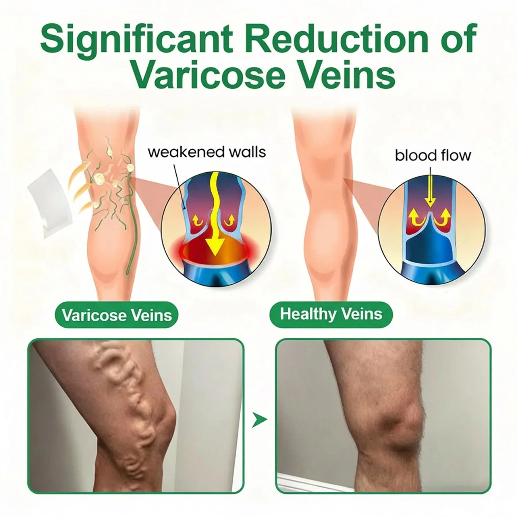 👨⚕️🔥Healrize® VeinEase Microneedle Care Patch⚡Instant Relief, Long-Term Results - Image 4
